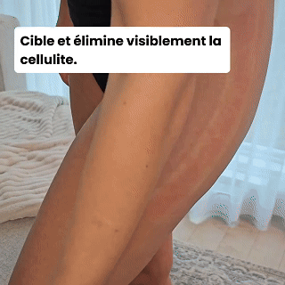 MIRAYA™ – Appareil Professionnel Anti-Cellulite 3-en-1